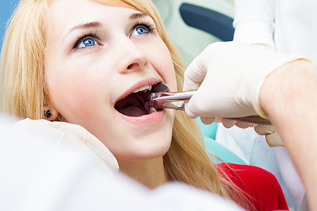 Grand Traverse Smile Center | Night Guards, Sedation Dentistry and Extractions